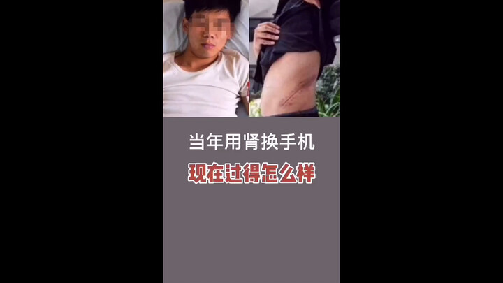 Những người ngày xưa đổi thận lấy điện thoại bây giờ sống thế nào?