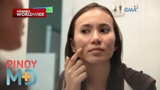 Dapat bang putukin o tirisin ang malaking tigyawat? | Pinoy MD