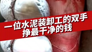 一位水泥装卸工父亲晒出自己的双手，网友：靠自己的努力，挣着最干净的钱，希望孩子们可以懂得父母的辛苦懂得节俭！