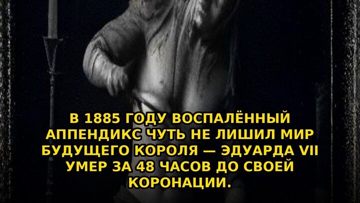 В 1885 году воспалённый аппендикс чуть не лишил мир будущего #shorts