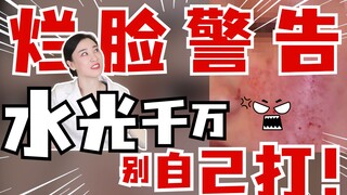 Jangan sekali-kali menyuntikkan filler wajah sendiri di rumah, hati-hati wajah jadi rusak!