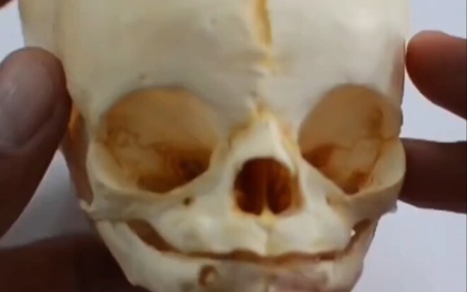 Teacher Xiaoti's Skull Specimen