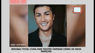 Gokil!! Berubah Total Cuma Pake Plester Langsung Bikin Pangling