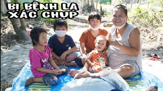 Người Phụ Nữ Mắc Bệnh Lạ, Bệnh Xác Chụp | Bốn Đứa Con Bỏ Trốn Khi Mẹ Lên Cơn