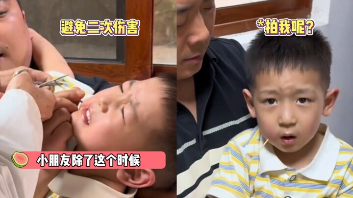 แก้มถูกไม้เสียบทะลุ แต่เด็กน้อยยังใจเย็นสุดๆ ไม่ร้องไห้หรืออาละวาดเลย