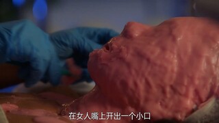 女人被蜜蜡堵住口鼻，无法呼吸危在旦夕！