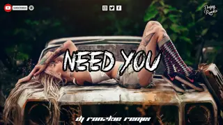 NEED YOU - EXBATTALION [ CHILL VIBE X BASS REMIX ] DJ RONZKIE REMIX