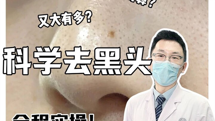 Bukan!! Ternyata menghilangkan komedo itu segampang ini?? Skin K memang juara!