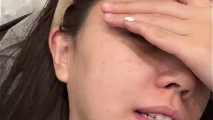 本来就磕碜这下好了 我看谁还乱整