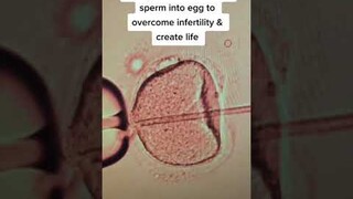 Real injection of sperm into a human egg to create a new life