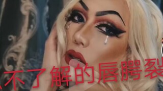 Nói về khe hở môi và vòm miệng, Hàn Mỹ Quyên chia sẻ: Tôi không phải là một chú hề, tôi chỉ là chính