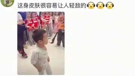Kulit ini mudah membuat orang meremehkan.