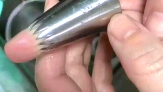 好痛啊！遇到这种情况应该怎么办？