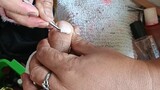 satisfying to watch dirty toe Nails (cleaning of to nails) part-1