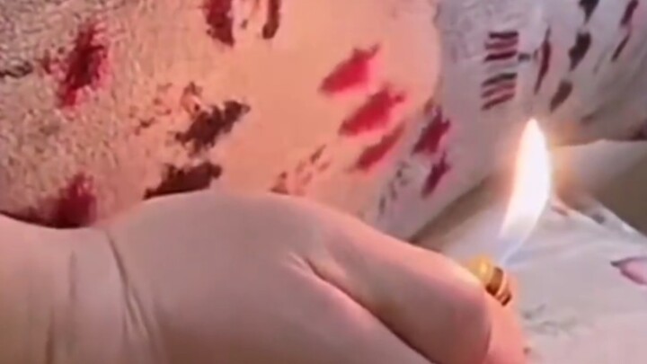 ตดสามารถจุดไฟติดได้ไหม?