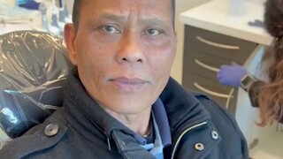 Seberapa besar perubahan sebelum dan sesudah implan gigi...Orang tua itu langsung berubah menjadi ka