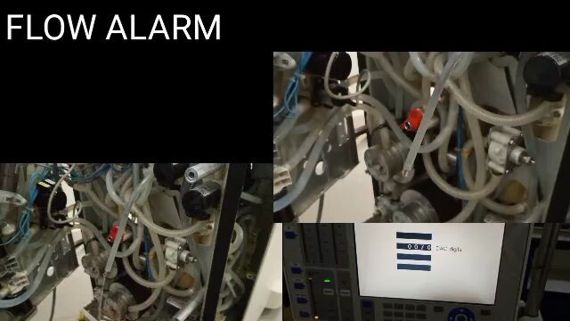 FRESENIUS 4008S | HOW TO FIX  FLOW ALARM  AND REMOVE AIR FROM SILICON HOSE FROM INSIDE