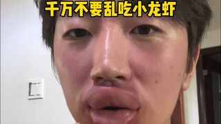 Tolong bantu pikirkan solusinya, apa yang harus kulakukan dengan mulutku yang bengkak?