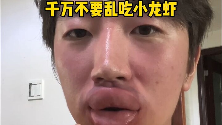 求大家想想办法 我的嘴肿该怎么办?