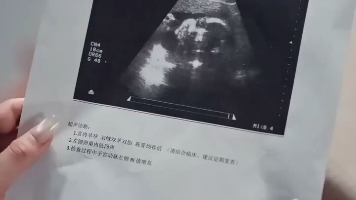 พนักงานสาวเผลอตัวกับซีอีโอผู้เย็นชา ไม่คิดว่าตั้งครรภ์ ในวันต่อมา