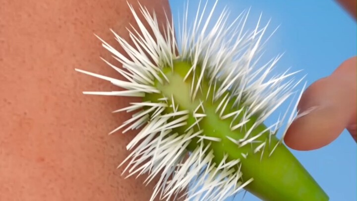 โดนเบ็ดเกี่ยวที่นิ้ว จะดึงออกได้เลยไหม? ดึงยังไงให้บาดเจ็บน้อยที่สุด?