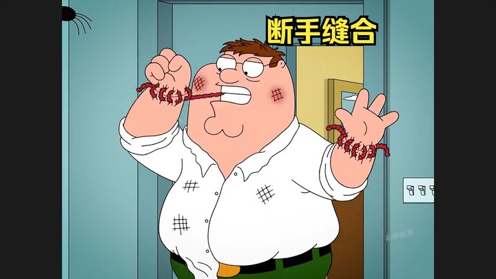 ปีเตอร์มือขาดทั้งสองข้าง แต่เขาเย็บกลับเข้าด้วยกันเอง