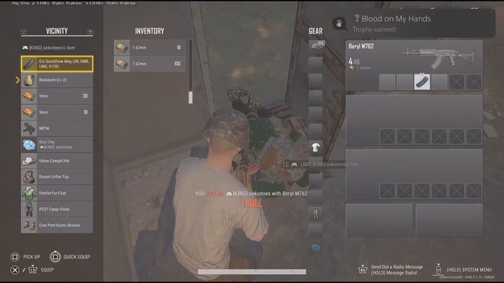 surprise heart attack moment