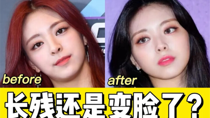 Sao Yuna giờ khác hẳn hồi mới debut vậy? Mũi rõ quá…