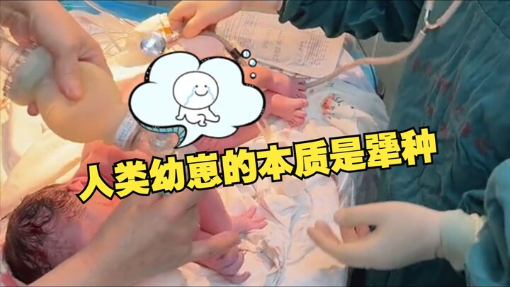 Newborn human babies are born stubborn through and through! Nurse: You’re really forcing me to pull 
