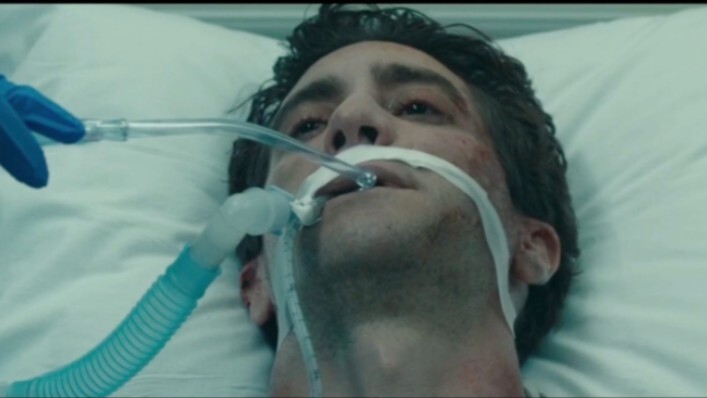 The injured puppy longs for his lover to stay/vomits after the tube is removed/pale face, dark bruis