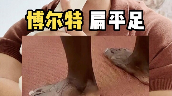 Orang tercepat di dunia adalah mereka yang bertapak datar.