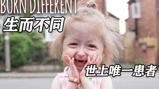 世上仅有的患有本杰明巴顿病的人，在积极拥抱爱与生活