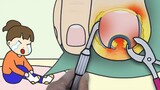 【定格动画】😵沉浸式治疗甲沟炎，护理看着就疼的脚趾嵌甲！｜治愈系短片