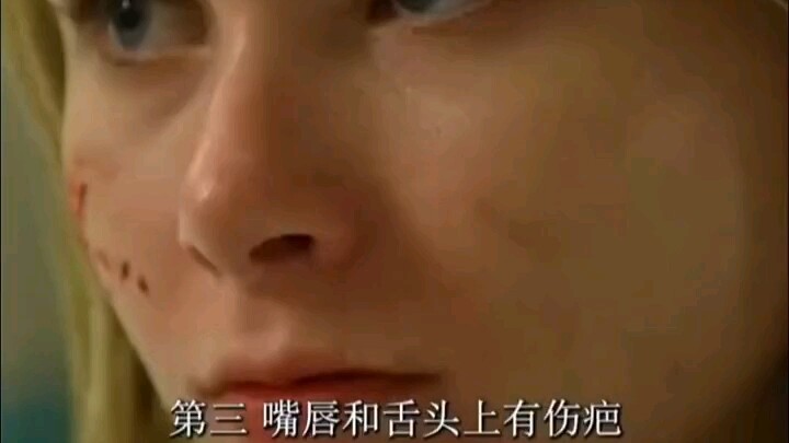 Theo cá nhân tôi, hội chứng không cảm nhận được đau là một trong những triệu chứng đáng sợ nhất trên