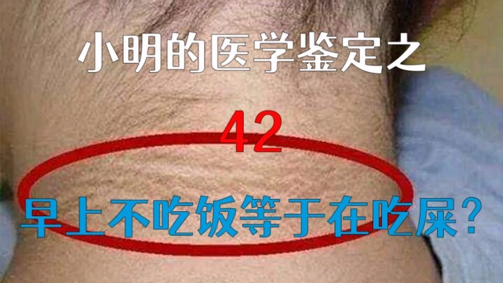 【เสี่ยวหมิง】การงดอาหารเช้าก็เหมือนกับการกินอุจจาระหรือเปล่า?