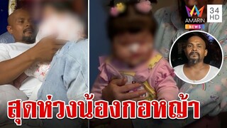 "หมอปลา" สุดห่วงพา "น้องกอหญ้า" ผ่าตัดด่วน ล่าสุดออก รพ.แล้ว | ทุบโต๊ะข่าว | 3/8/67