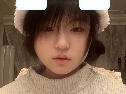 My ex-boyfriend/ girlfriend burned me with a cigarette butt.