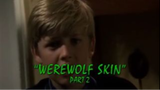 Goosebumps: Season 3, Episode 14 "Werewolf Skin: Part 2"