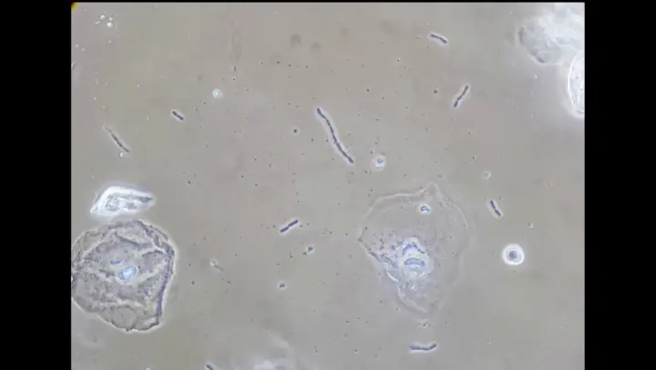 Bacterial growth, phase contrast, 1h37s time lapse