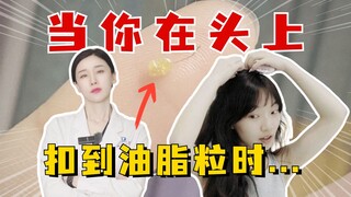 Một sở thích đặc biệt - nhặt những hạt dầu trên da đầu! Ai cũng làm vậy sao?
