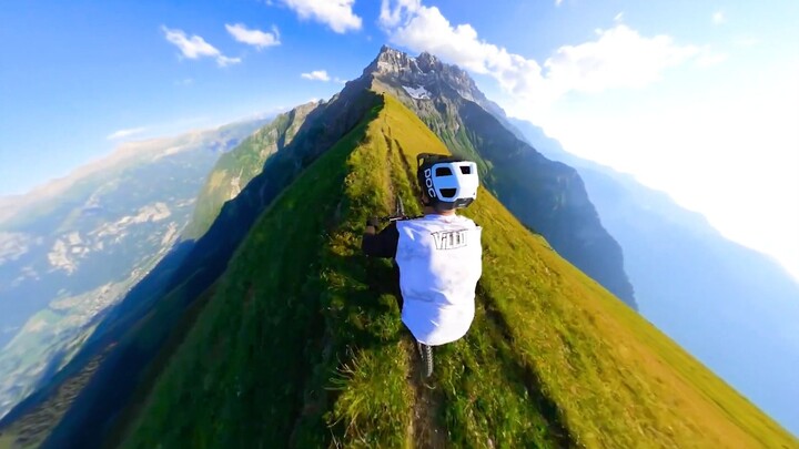 I’m 20 and still don’t have a camera on my head—is that normal?!