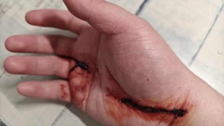 พรุ่งนี้ต้องสอบเข้ามหาวิทยาลัย แต่วันนี้อยู่บ้านไม่ได้ทำอะไรเลยจนทำให้ฝ่ามือขวาบาดเจ็บไปทั้งหมด