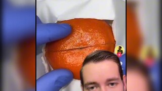 橙 子 先 生 你 没 事 吧