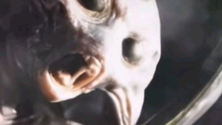 I heard you don’t have any white blood cells.