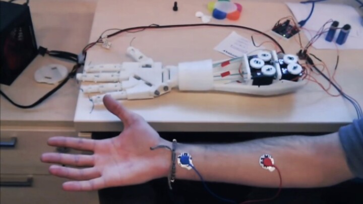 The Bionic Arm Is Your Lie