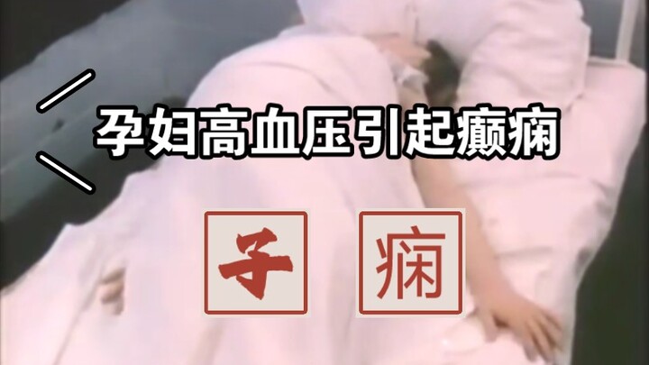 تشنجات حادة ناجمة عن ارتفاع ضغط الدم الشديد لدى امرأة حامل: لقطات نادرة من عام 1984
