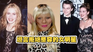 ثمانية من نجمات هوليوود اللواتي أعلنَّ بصراحة أمام وسائل الإعلام رفضهن لعمليات التجميل!