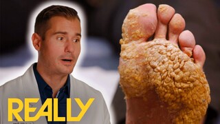 “Top 3 Most Perplexing Cases Ever” Doctor Shocked | My Feet Are Killing Me