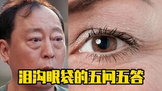 Lima Pertanyaan dan Lima Jawaban tentang Garis Air Mata dan Kantung Mata