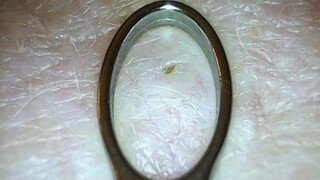 มันออกมาจากหลังของเขา